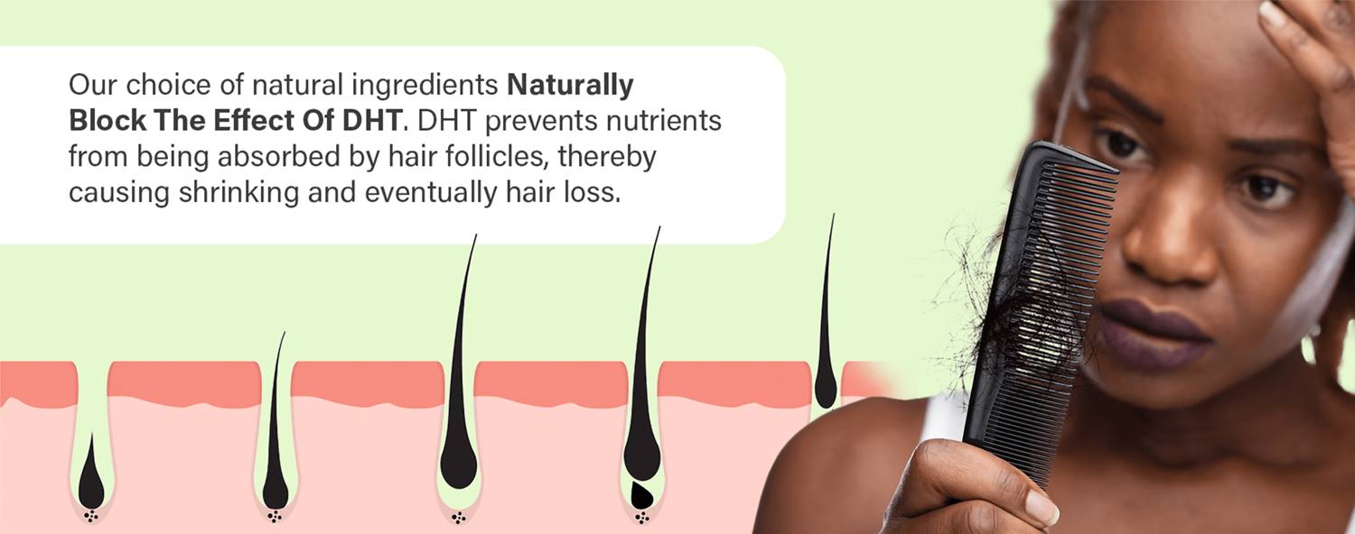 dht-hair-loss-banner
